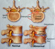 The Spine and Pain