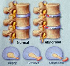 The Spine and Pain