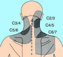 The Spine and Pain